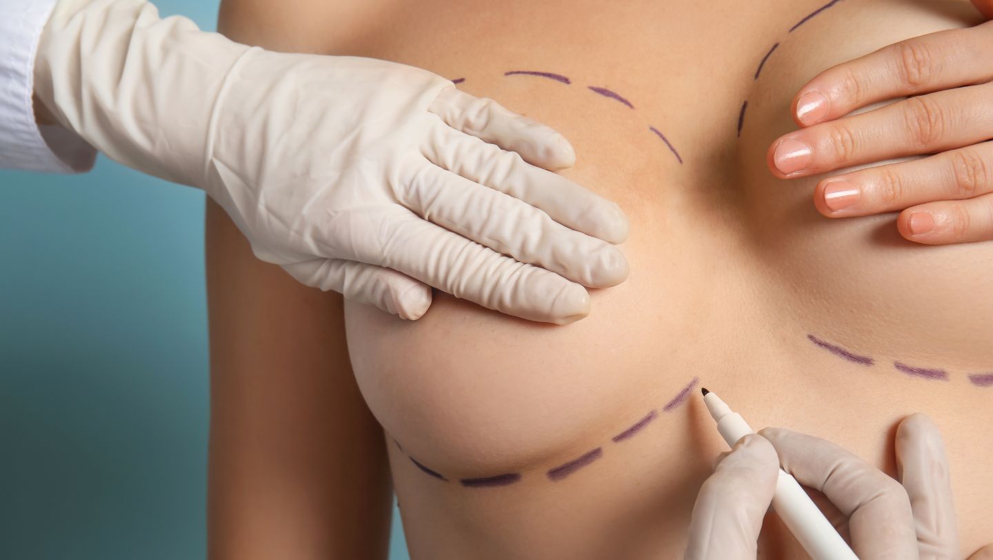 Breast Reduction