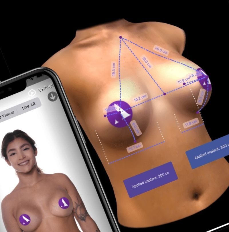 Arbrea 3D Simulation