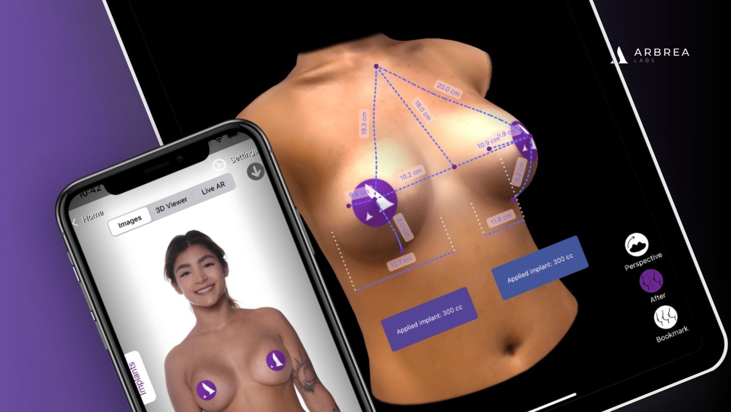 Arbrea 3D Simulation